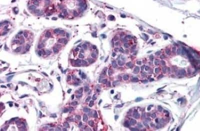 Immunohistochemistry-Paraffin: Melanotransferrin/CD228/MFI2 Antibody [NBP3-14564]